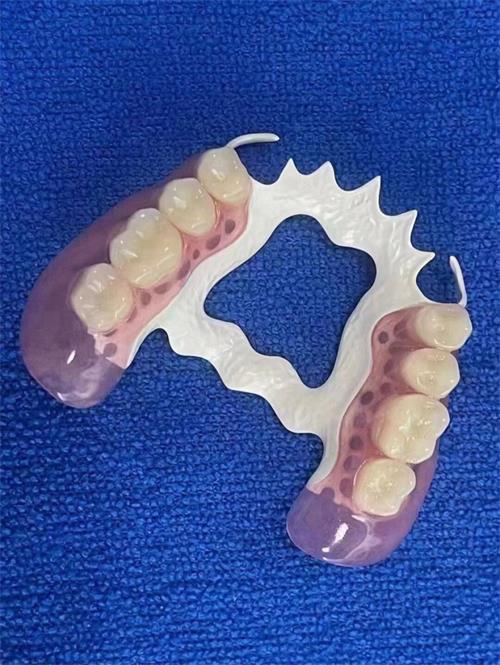 常見的義齒有哪些(圖2)